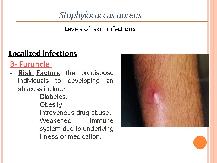 Staphylococcus aureus Levels of skin infections Localized infections B- Furuncle - Risk Factors: that