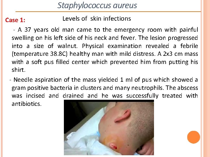 Staphylococcus aureus Levels of skin infections Case 1: - A 37 years old man