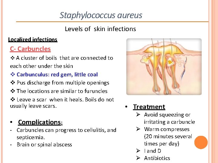 Staphylococcus aureus Levels of skin infections Localized infections C- Carbuncles v A cluster of