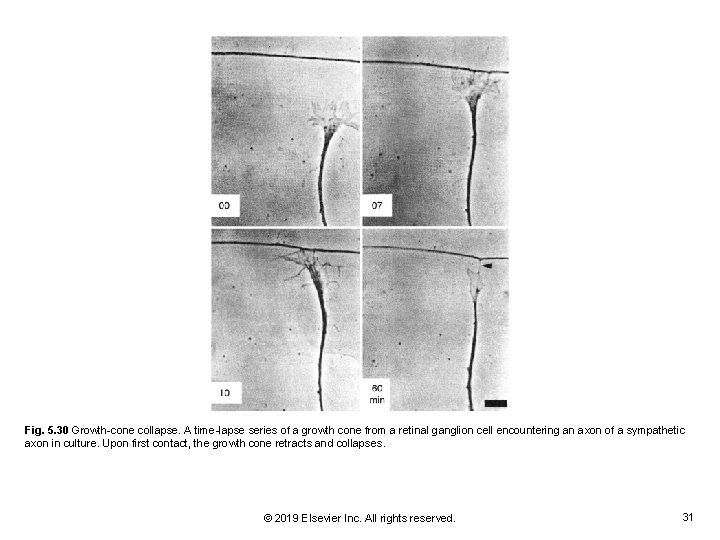 Fig. 5. 30 Growth-cone collapse. A time-lapse series of a growth cone from a