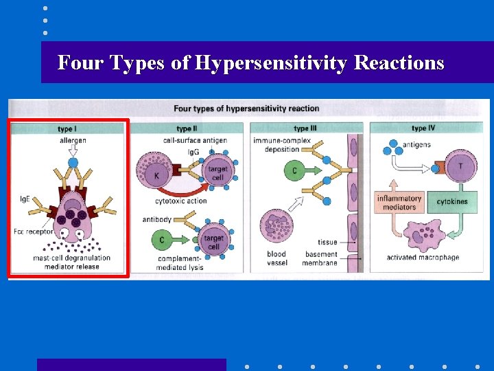 Four Types of Hypersensitivity Reactions 