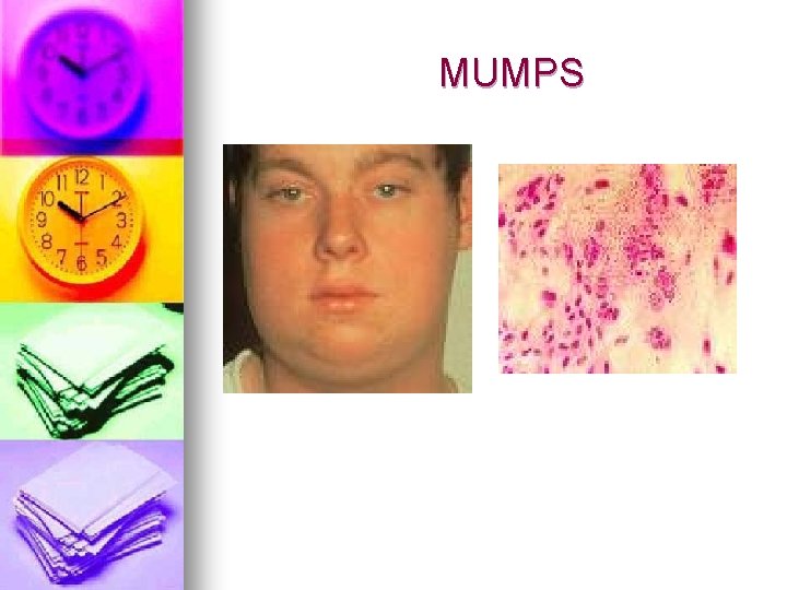 MUMPS 