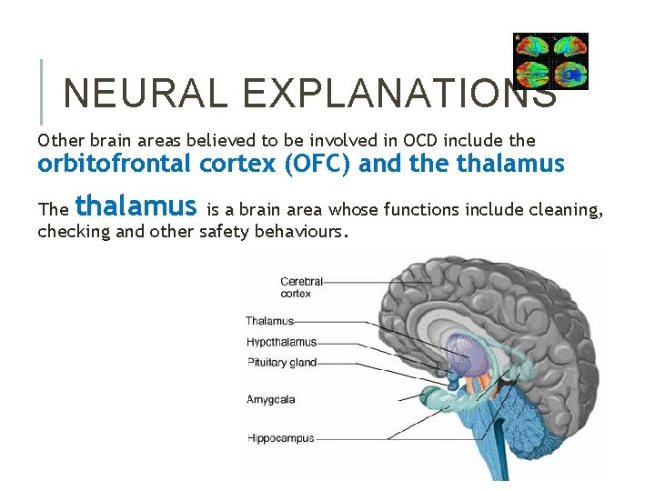 NEURAL EXPLANATIONS Other brain areas believed to be involved in OCD include the orbitofrontal