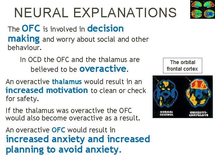 NEURAL EXPLANATIONS OFC is involved in decision making and worry about social and other