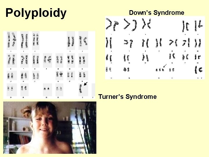 Polyploidy Down’s Syndrome Turner’s Syndrome 