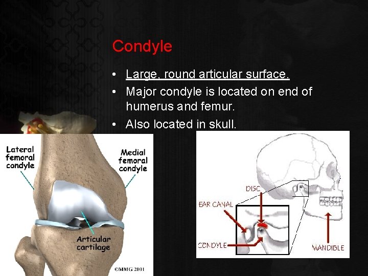 Condyle • Large, round articular surface. • Major condyle is located on end of