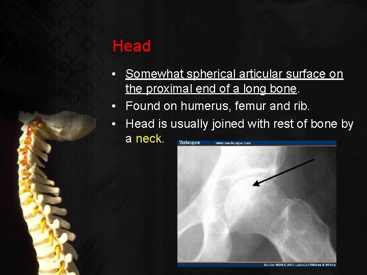 Head • Somewhat spherical articular surface on the proximal end of a long bone.
