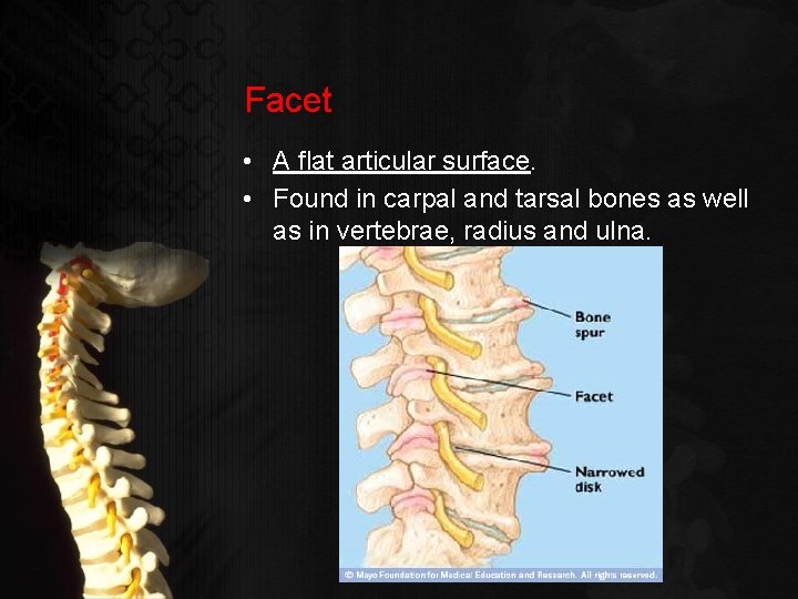 Facet • A flat articular surface. • Found in carpal and tarsal bones as