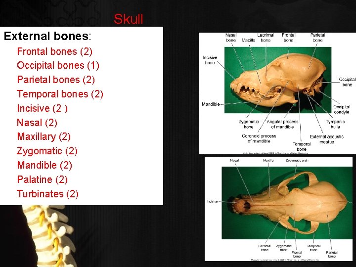 Skull External bones: Frontal bones (2) Occipital bones (1) Parietal bones (2) Temporal bones