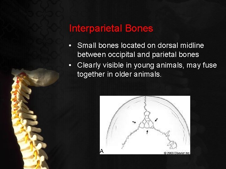 Interparietal Bones • Small bones located on dorsal midline between occipital and parietal bones