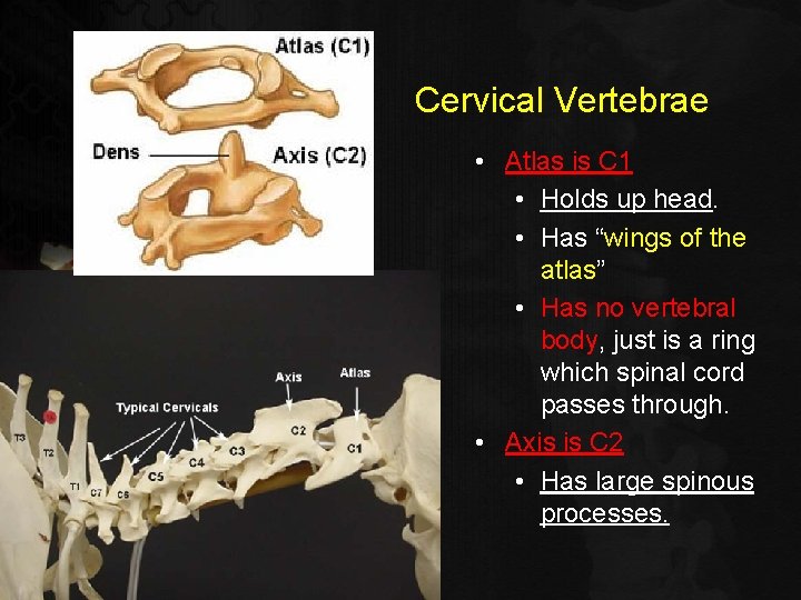 Cervical Vertebrae • Atlas is C 1 • Holds up head. • Has “wings