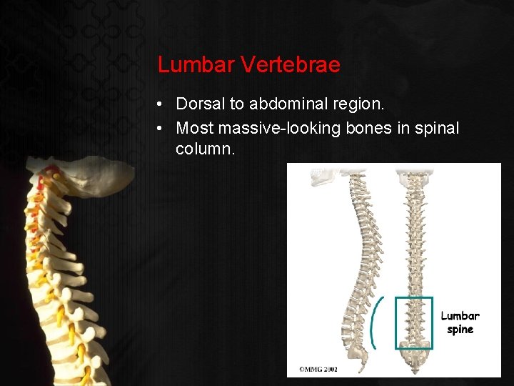 Lumbar Vertebrae • Dorsal to abdominal region. • Most massive-looking bones in spinal column.