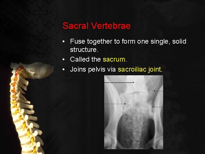 Sacral Vertebrae • Fuse together to form one single, solid structure. • Called the