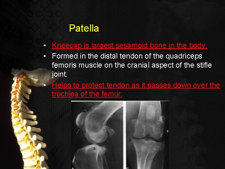 Patella • Kneecap is largest sesamoid bone in the body. • Formed in the