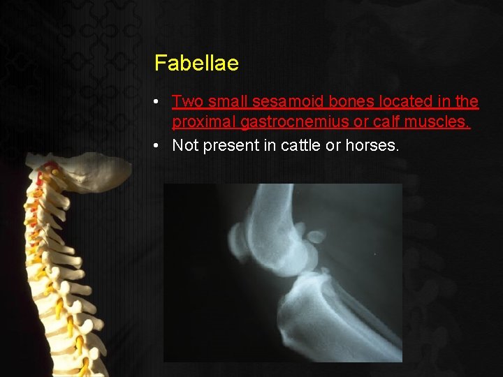 Fabellae • Two small sesamoid bones located in the proximal gastrocnemius or calf muscles.