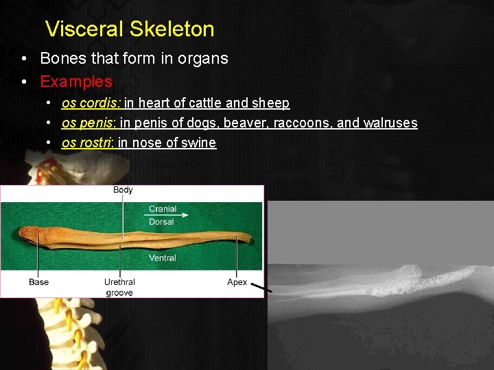 Visceral Skeleton • Bones that form in organs • Examples • os cordis: in