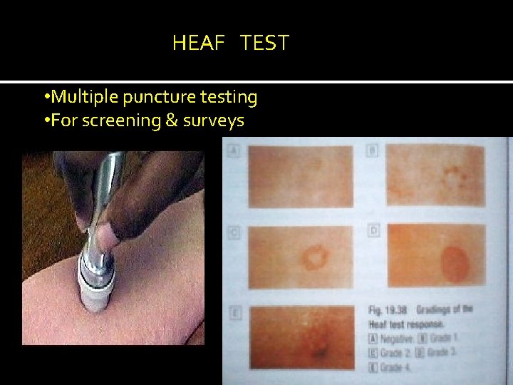 HEAF TEST • Multiple puncture testing • For screening & surveys 