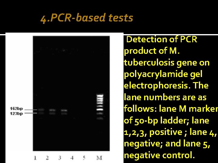 4. PCR-based tests Detection of PCR product of M. tuberculosis gene on polyacrylamide gel