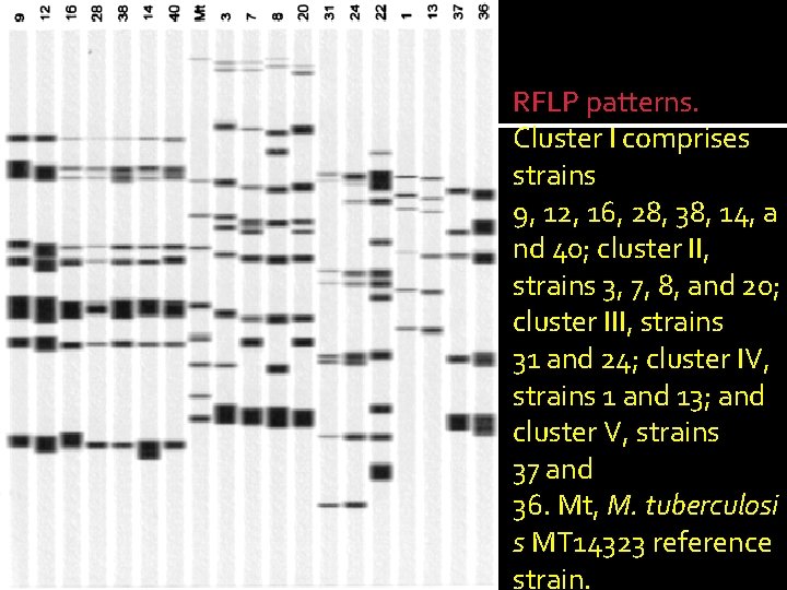 RFLP patterns. Cluster I comprises strains 9, 12, 16, 28, 38, 14, a nd