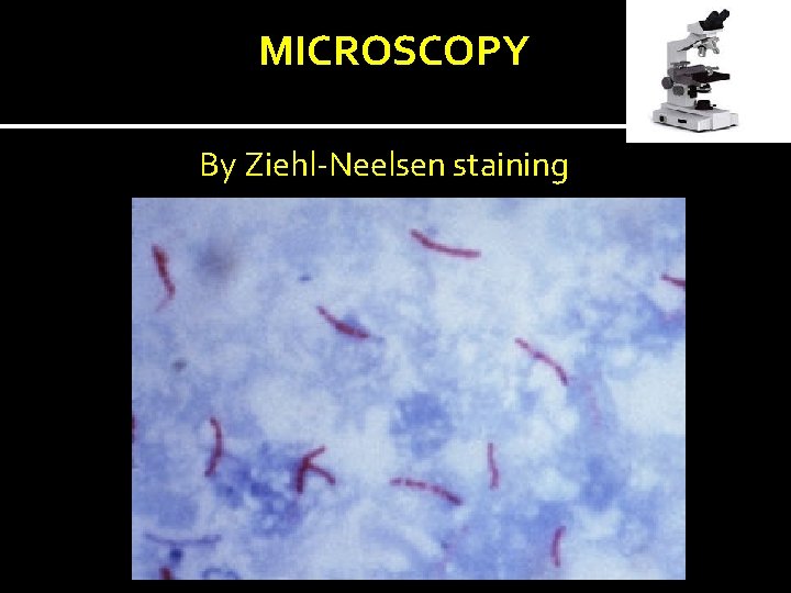 MICROSCOPY By Ziehl-Neelsen staining 