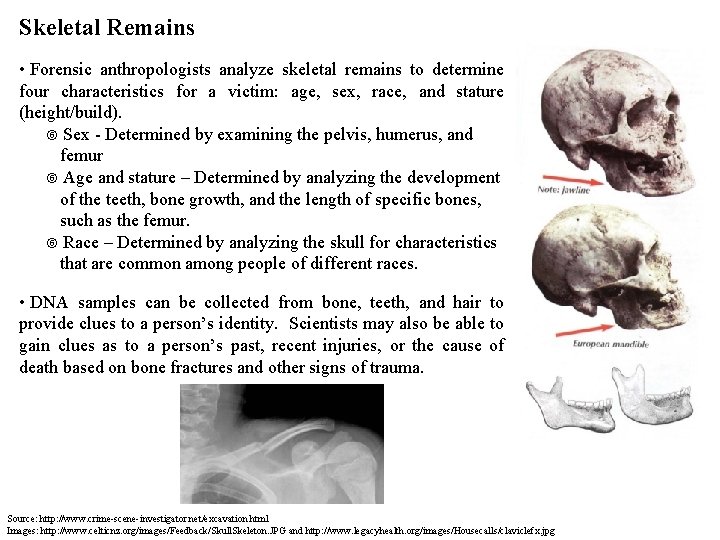 Skeletal Remains • Forensic anthropologists analyze skeletal remains to determine four characteristics for a