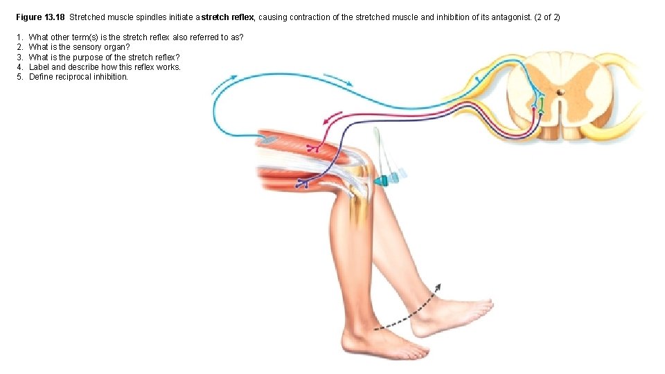 Figure 13. 18 Stretched muscle spindles initiate a stretch reflex, causing contraction of the