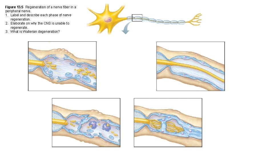 Figure 13. 5 Regeneration of a nerve fiber in a peripheral nerve. 1. Label