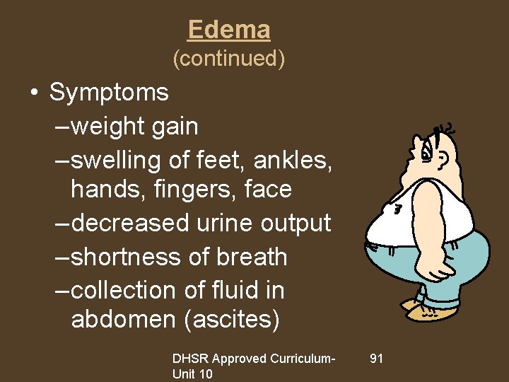 Edema (continued) • Symptoms – weight gain – swelling of feet, ankles, hands, fingers,