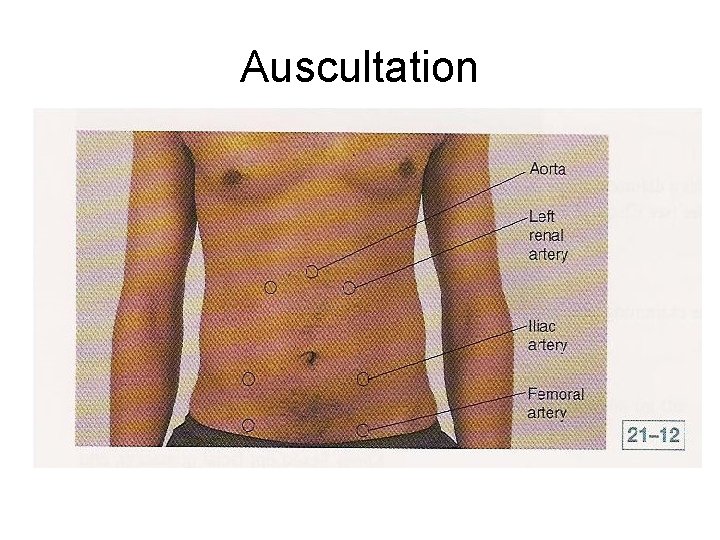 Auscultation 