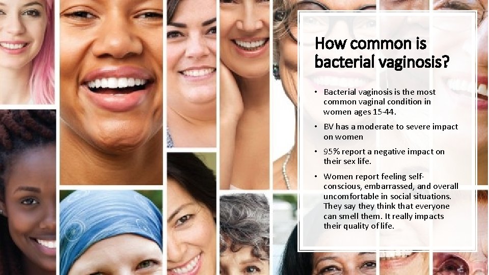 How common is bacterial vaginosis? • Bacterial vaginosis is the most common vaginal condition