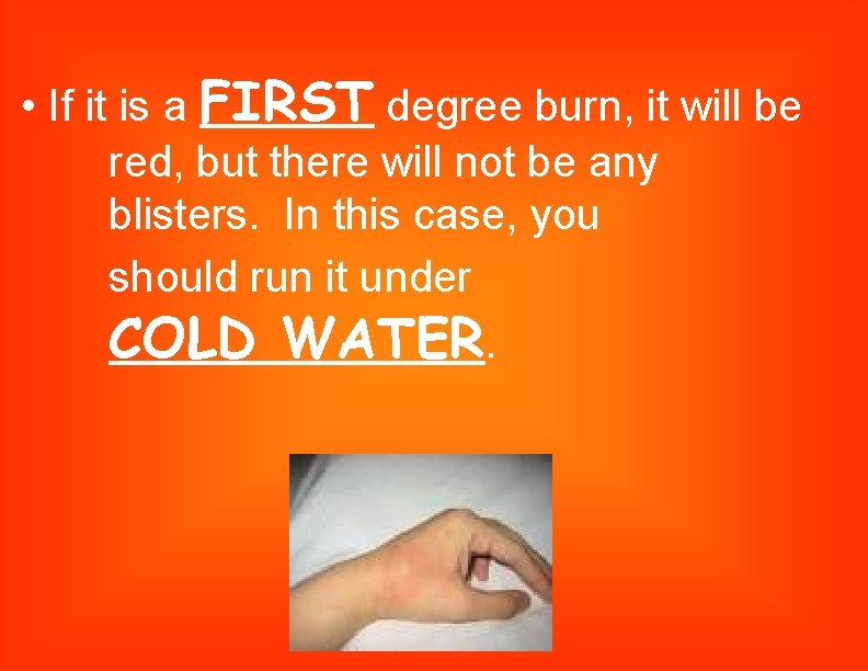  • If it is a FIRST degree burn, it will be red, but