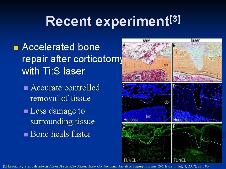 Recent experiment[3] n Accelerated bone repair after corticotomy with Ti: S laser Accurate controlled