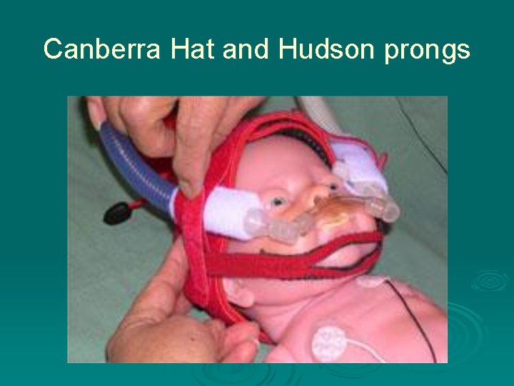 Canberra Hat and Hudson prongs 