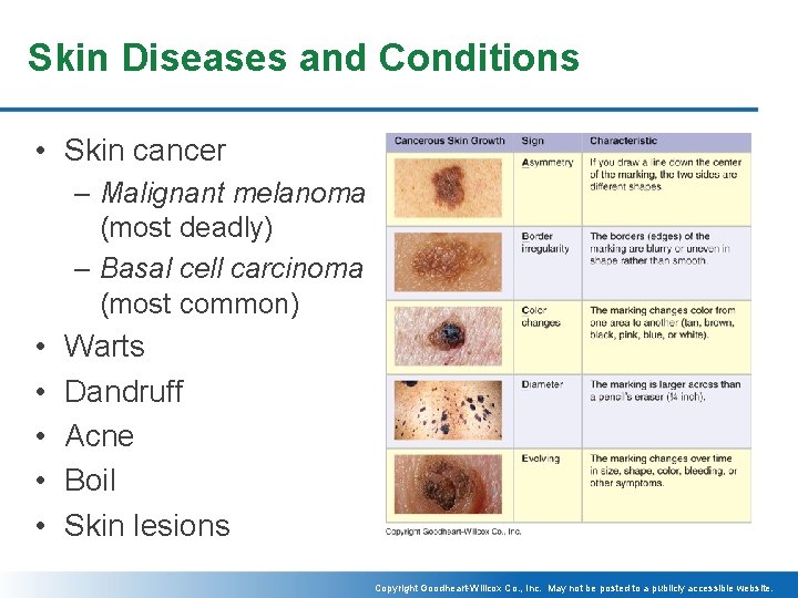 Skin Diseases and Conditions • Skin cancer – Malignant melanoma (most deadly) – Basal