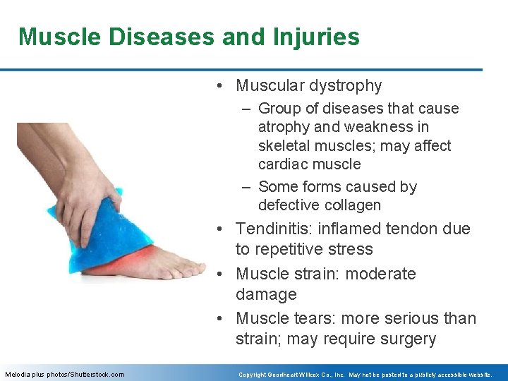 Muscle Diseases and Injuries • Muscular dystrophy – Group of diseases that cause atrophy