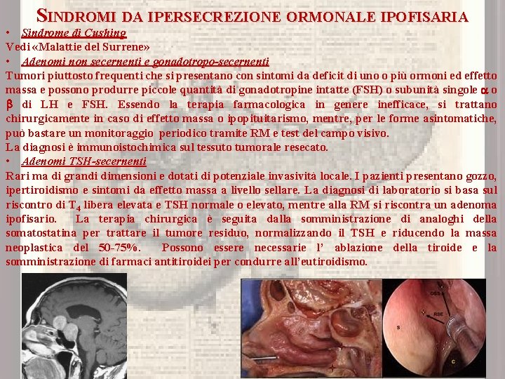 SINDROMI DA IPERSECREZIONE ORMONALE IPOFISARIA • Sindrome di Cushing Vedi «Malattie del Surrene» •