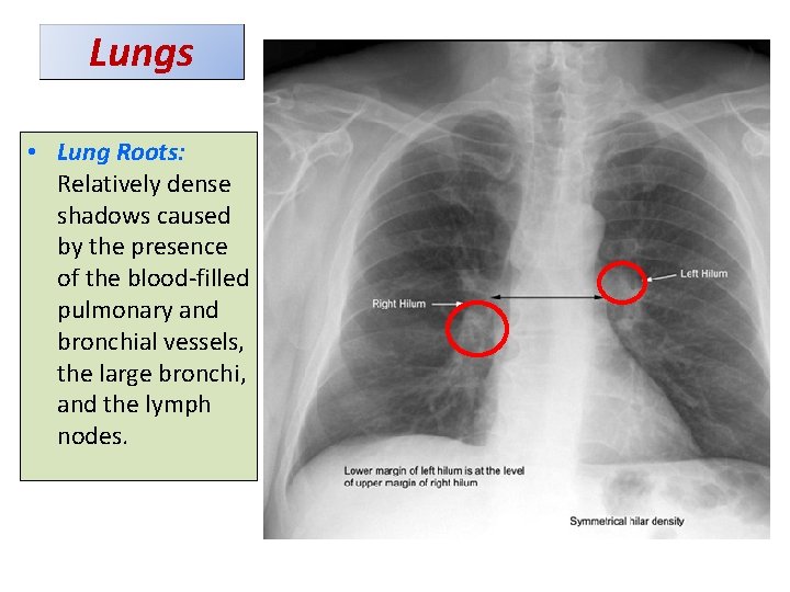 Lungs • Lung Roots: Relatively dense shadows caused by the presence of the blood-filled