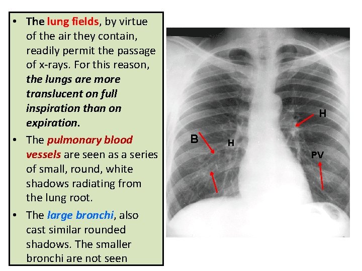  • The lung fields, by virtue of the air they contain, readily permit