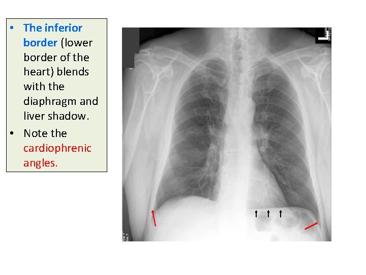  • The inferior border (lower border of the heart) blends with the diaphragm