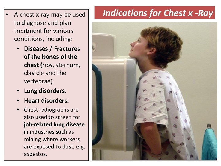  • A chest x-ray may be used to diagnose and plan treatment for