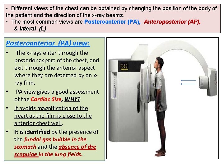  • Different views of the chest can be obtained by changing the position
