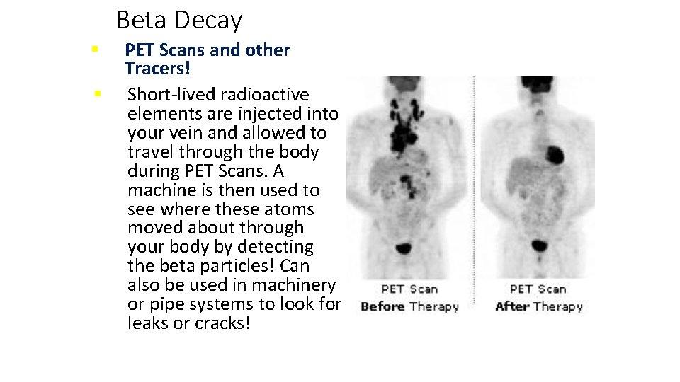 Beta Decay § § PET Scans and other Tracers! Short-lived radioactive elements are injected