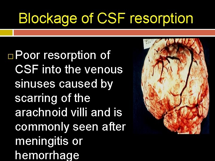 Blockage of CSF resorption Poor resorption of CSF into the venous sinuses caused by