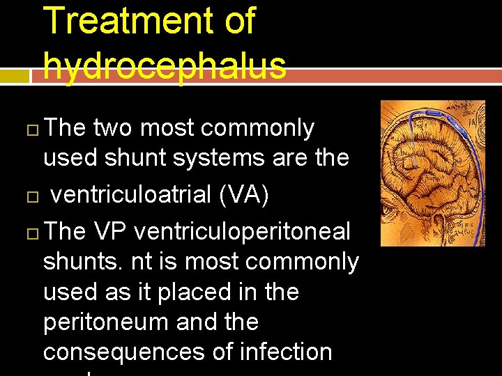 Treatment of hydrocephalus The two most commonly used shunt systems are the ventriculoatrial (VA)