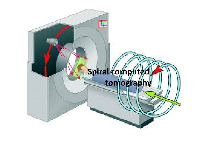 Spiral computed tomography 