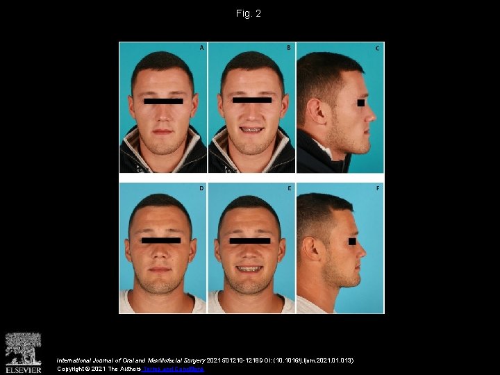 Fig. 2 International Journal of Oral and Maxillofacial Surgery 2021 501210 -1218 DOI: (10.
