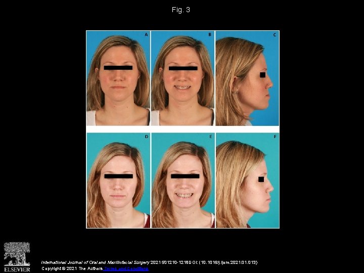 Fig. 3 International Journal of Oral and Maxillofacial Surgery 2021 501210 -1218 DOI: (10.