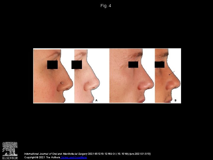 Fig. 4 International Journal of Oral and Maxillofacial Surgery 2021 501210 -1218 DOI: (10.