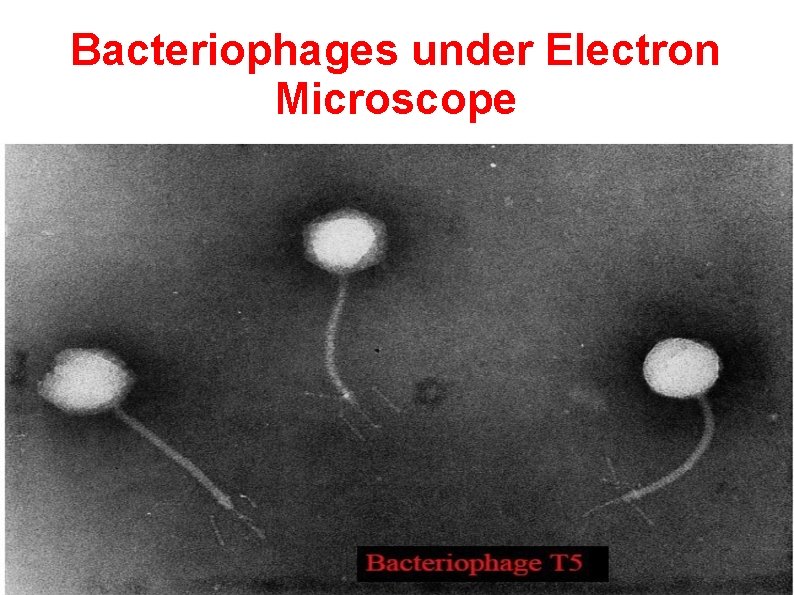 Bacteriophages under Electron Microscope 