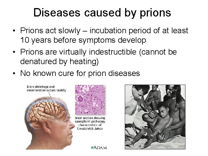 Diseases caused by prions • Prions act slowly – incubation period of at least